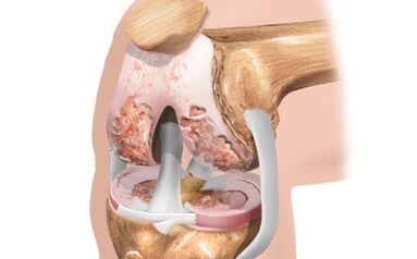 Scheme of the ligaments
