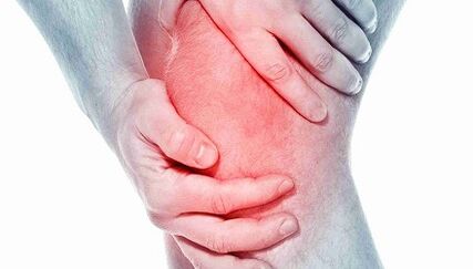 Arthrosis of the knee