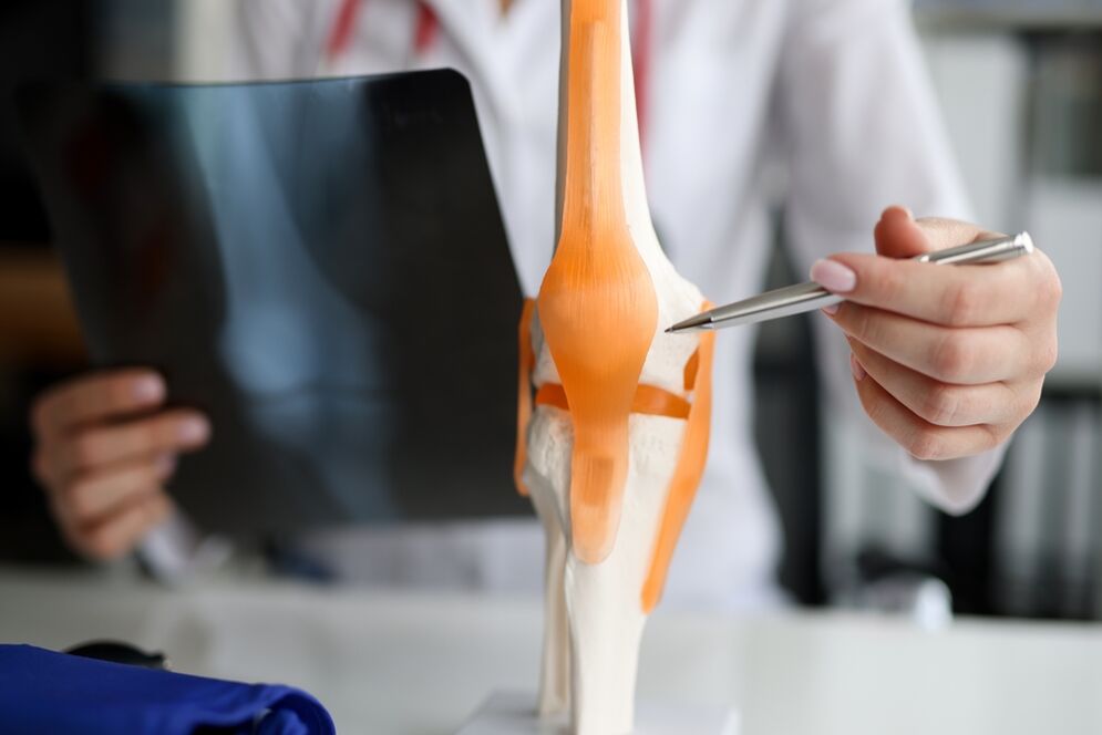 Demonstration of a joint in which degenerative changes lead to the development of arthrosis